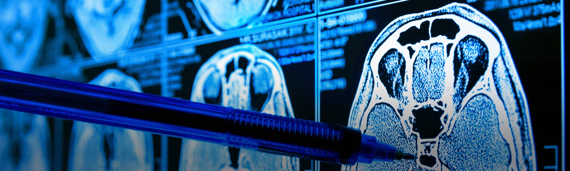 360° 3D Medical Imaging Powered by Neousys Edge AI Platform